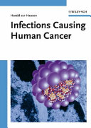 Infections causing human cancer /